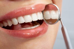 Whole Mouth Dental Implants