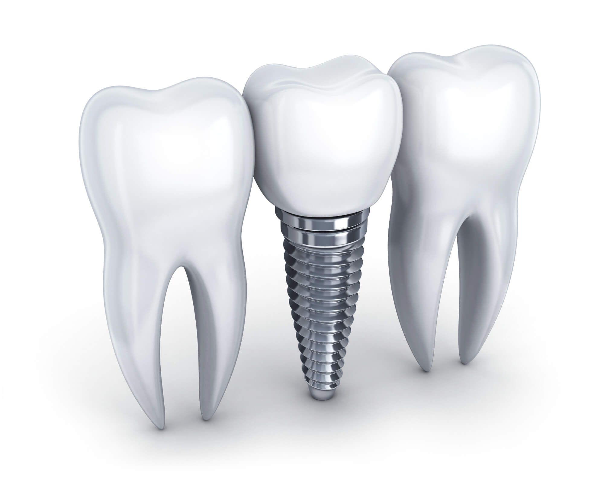 Dental implant and tooth