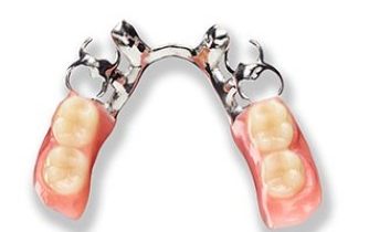 Partial Denture