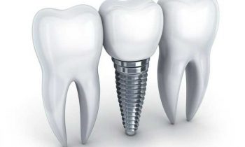 Strong Dental
