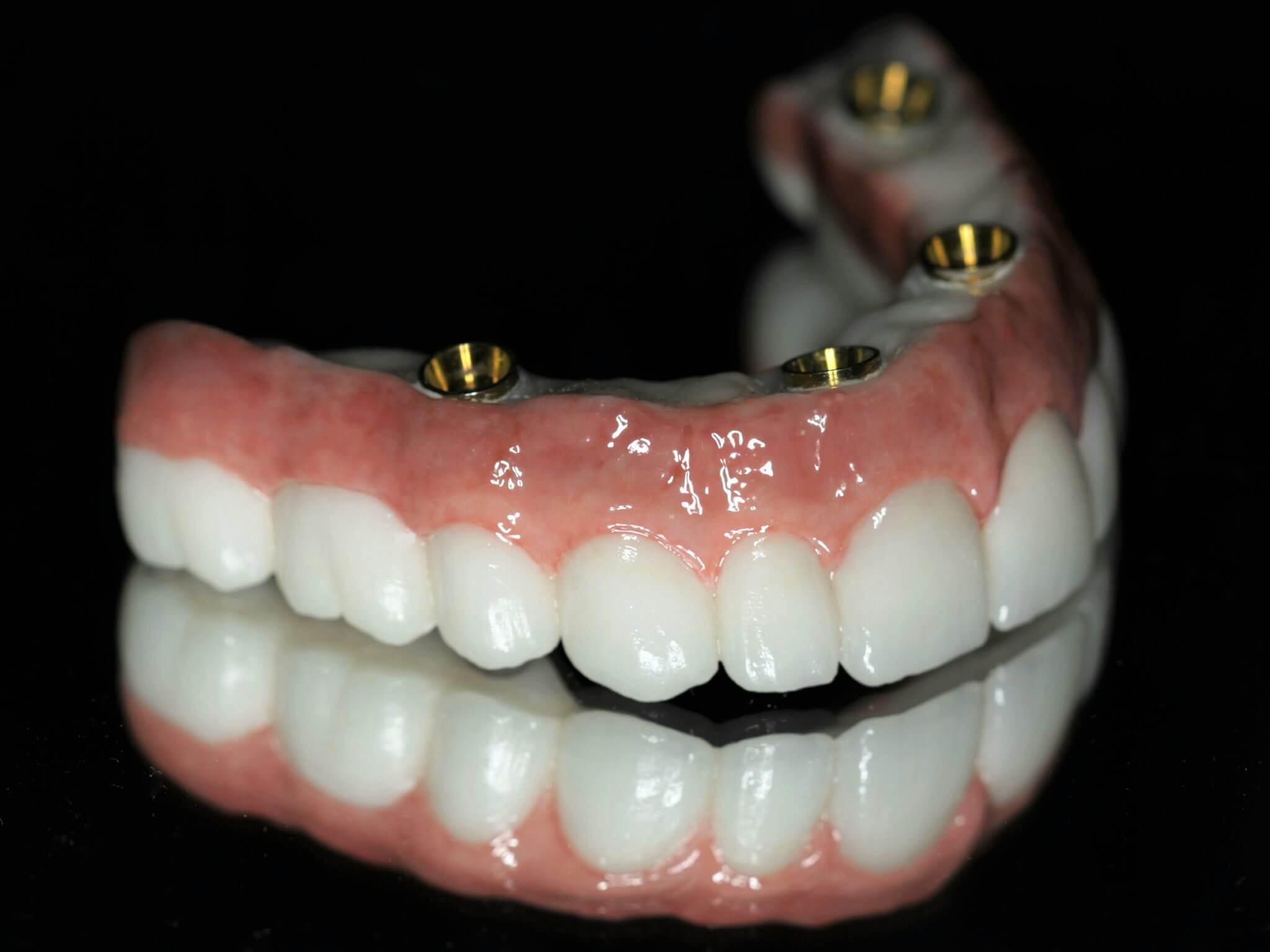 Full Mouth Dental Implants Denture Implants All On 4 Dental Implants