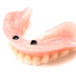 Are Snap On Dentures Reusable