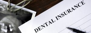 El seguro cubre los implantes dentales