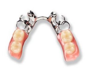 partial denture cost