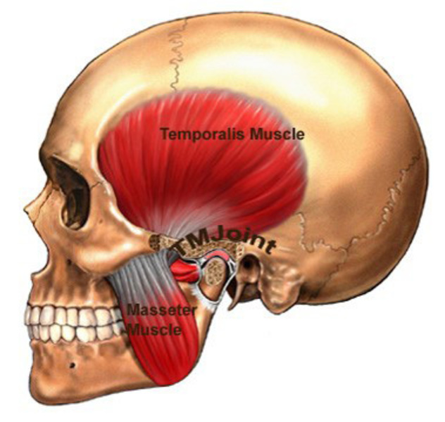 Dolor en la mandíbula, articulación temporomandibular (ATM) 