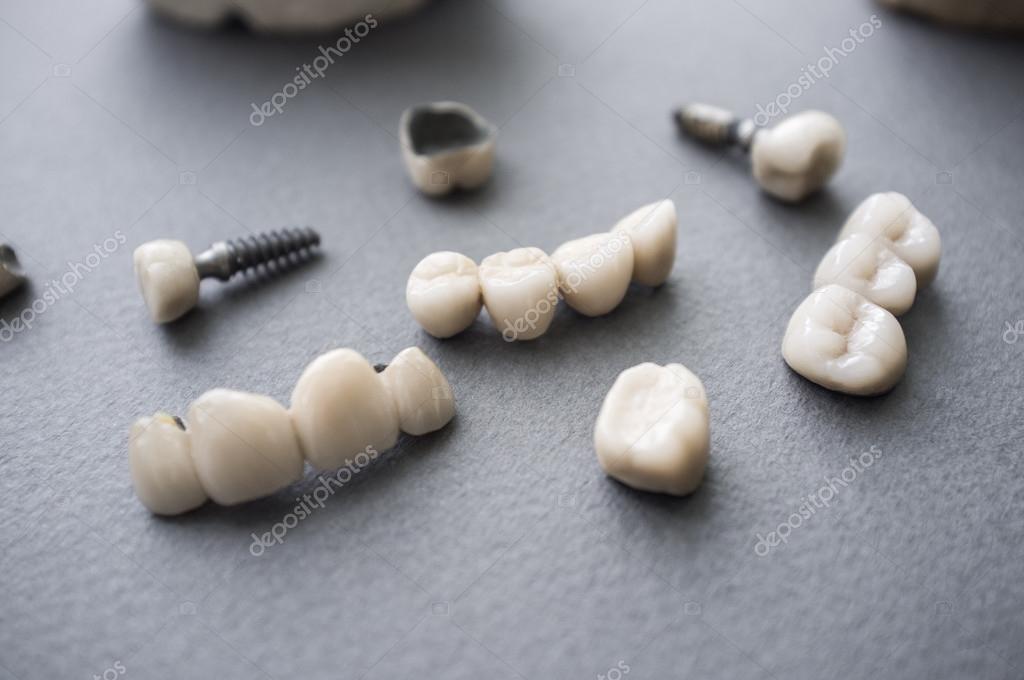 broken crown tooth