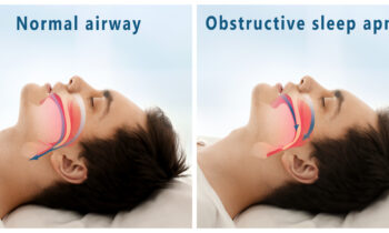 Snore problem concept. Illustration of normal airway and obstructive sleep apnea