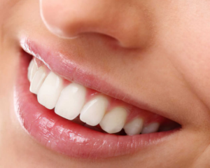 restoration teeth cost