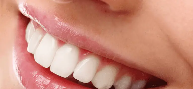 Sensitive teeth