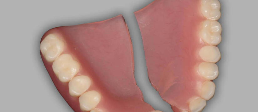 Denture Repair and Relining