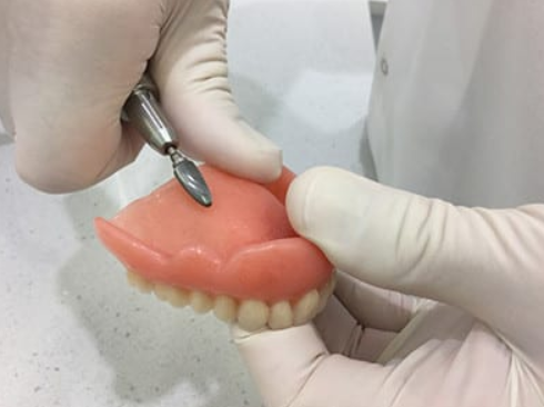 Denture repair and relining