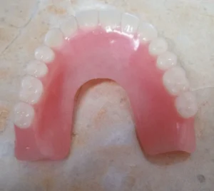 horseshoe dentures