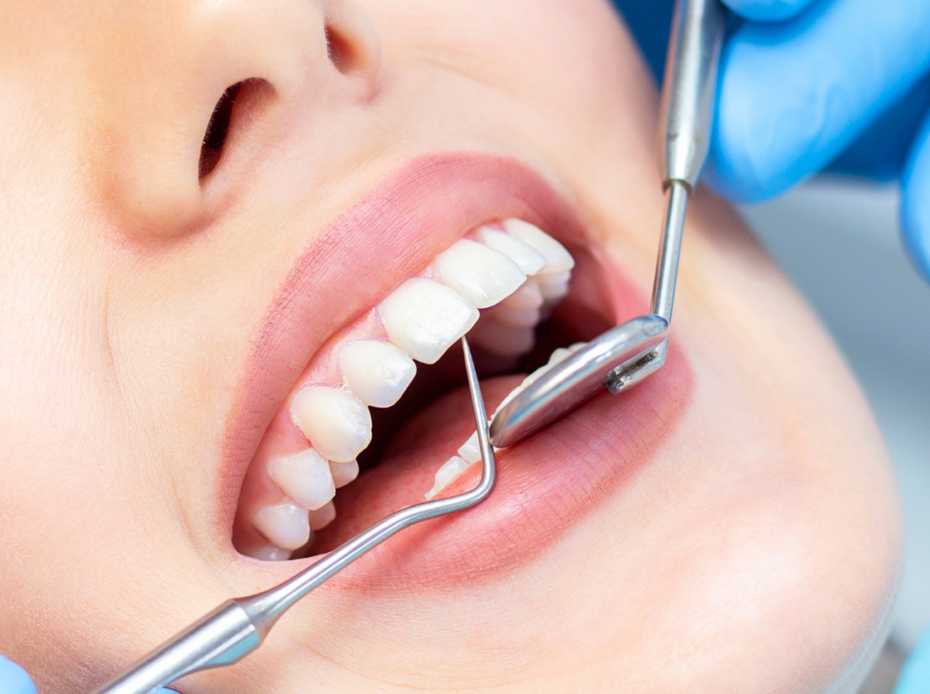 Dental implant