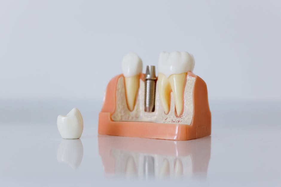 Discover the ideal solution for your smile - full mouth implants await in 'Full Mouth Implants vs. Dentures: Making the Right Choice for Your Smile'.
