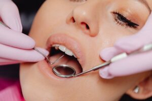 A Patient’s Guide to Invisalign in Rockville: What to Expect