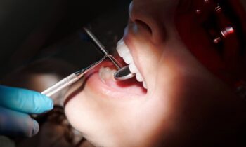 The Latest Advances in Dental Bridge Technology and Repair Techniques