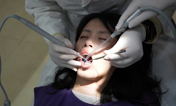 Root Canal Myths Debunked