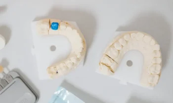 Dental mold for teeth