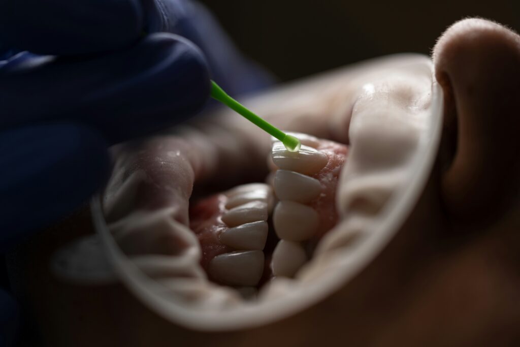 Root Canals vs. Tooth Extraction