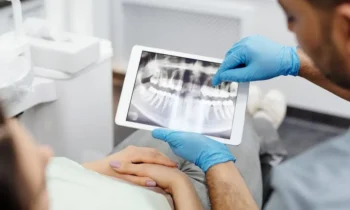 ¿Qué son los implantes dentales y cómo funcionan?