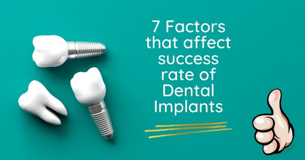 Success Rate Of Dental Implants