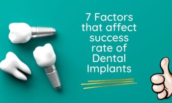 Success Rate Of Dental Implants