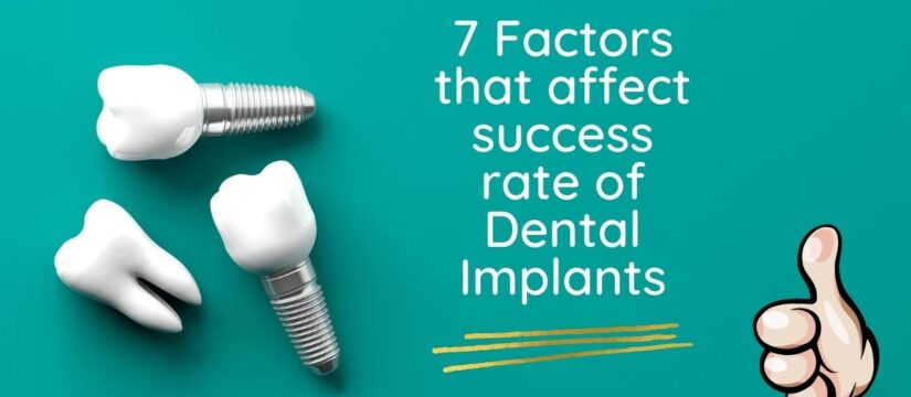 Success Rate Of Dental Implants