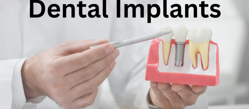 Before and after images of dental implants, highlighting improved smiles.