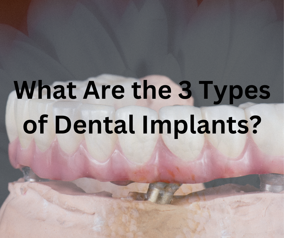 Types of Dental Implants