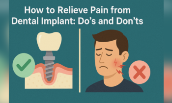 implant recovery dos and don’ts