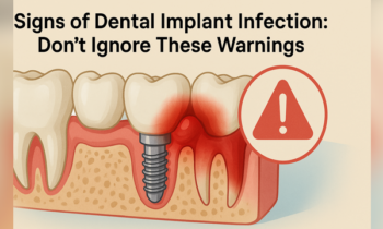 dental implant infection signs