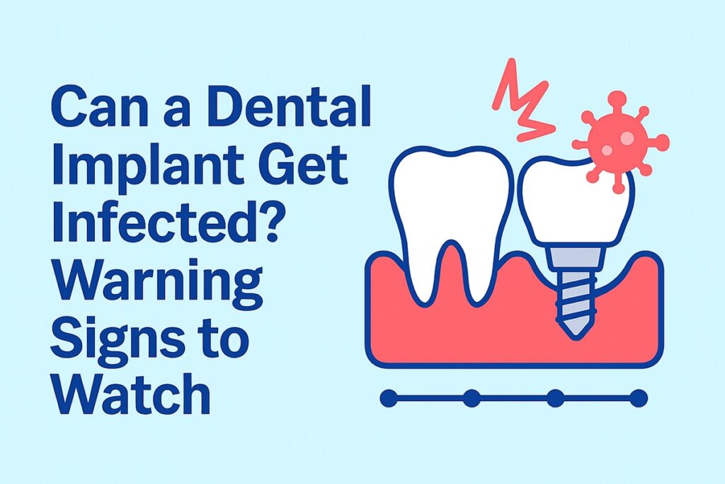 Can a Dental Implant Get Infected Warning Signs to Watch