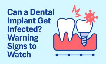 Can a Dental Implant Get Infected Warning Signs to Watch