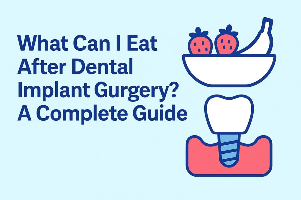 What Can I Eat After Dental Implant Surgery A Complete Guide