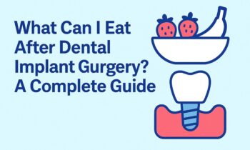 What Can I Eat After Dental Implant Surgery A Complete Guide
