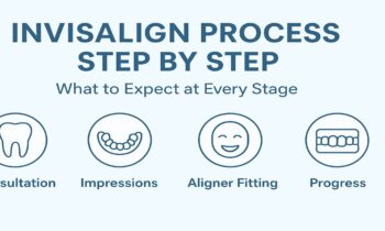 Invisalign Process Step by Step What to Expect at Every Stage