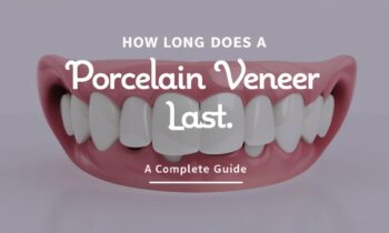 Porcelain Veneer Process Explained Step by Step for Patients