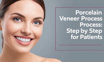 Tooth Preparation for Porcelain Veneer Step by Step Guide