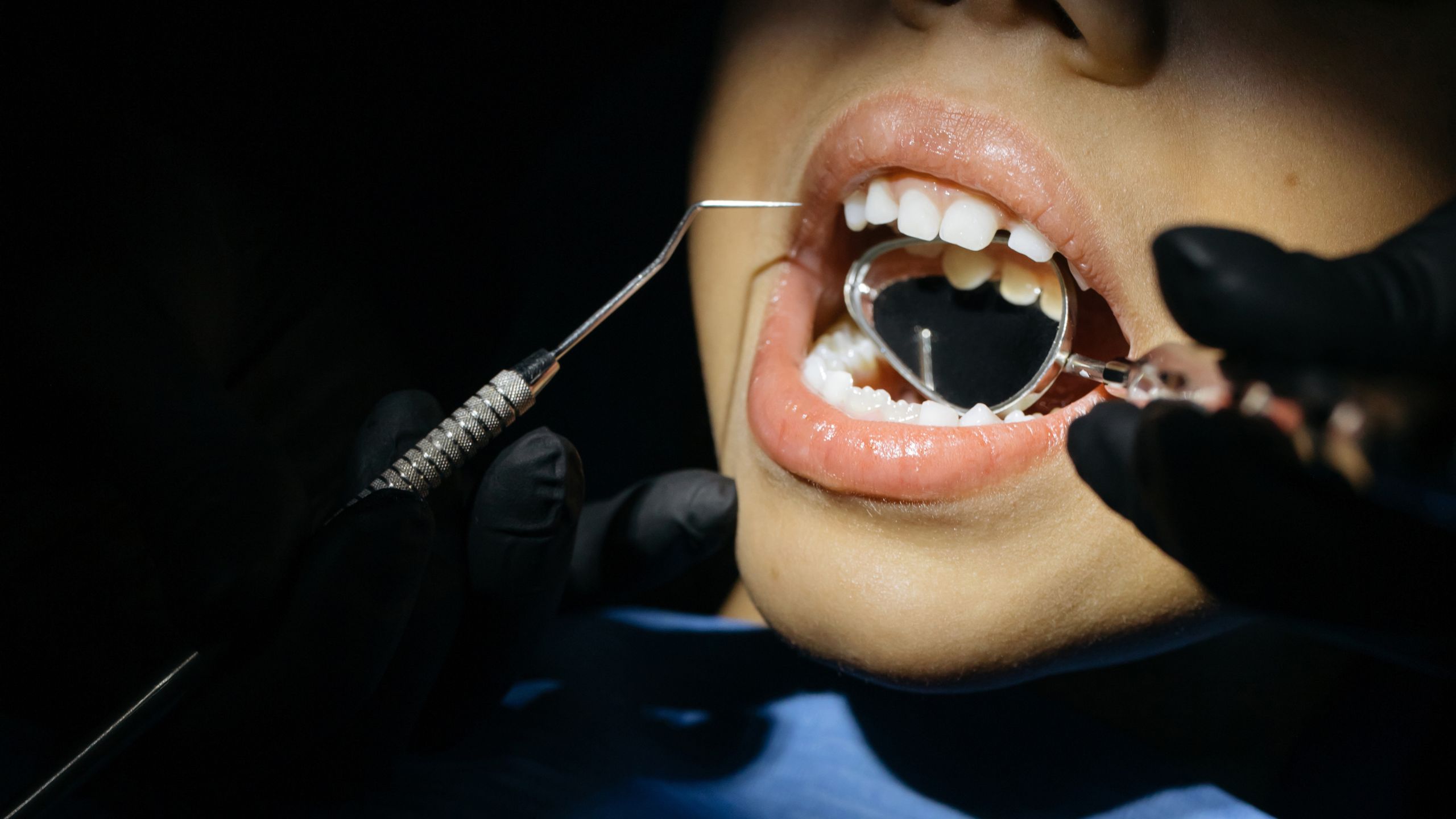 dental crown vs onlay