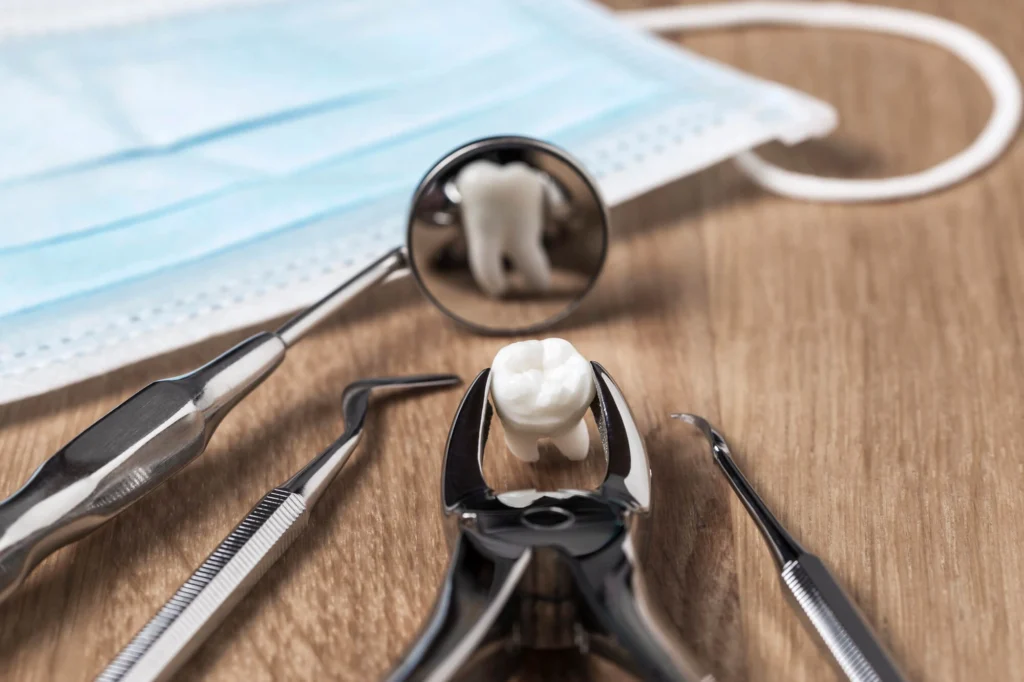 tooth extraction rockville